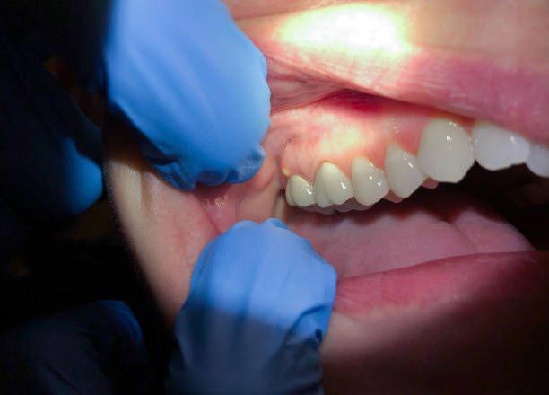 Best Cracked Tooth Emergency Dentist  in USA